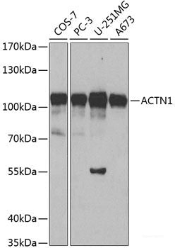 Western blot analysis of extracts of various cell lines using RPL38 Polyclonal Antibody at dilution of 1:3000.