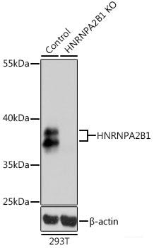 Immunofluorescence analysis of C6 cells using CTSL Polyclonal Antibody at dilution of 1:100. Blue: DAPI for nuclear staining.
