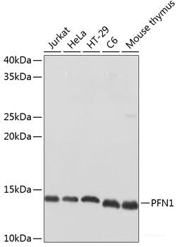 Immunofluorescence analysis of C6 cells using RAB21 Polyclonal Antibody at dilution of 1:100. Blue: DAPI for nuclear staining.