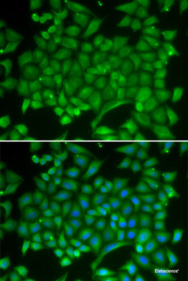 Immunohistochemistry of paraffin-embedded Rat brain using UGDH Polyclonal Antibody at dilution of 1:100 (40x lens).