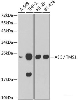 Western blot analysis of extracts of various cell lines using SART3 Polyclonal Antibody at dilution of 1:3000.