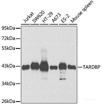 Western blot analysis of extracts of various cell lines using IKZF2 Polyclonal Antibody at dilution of 1:3000.