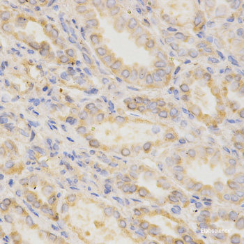 Immunofluorescence analysis of A549 cells using CD55 Polyclonal Antibody
