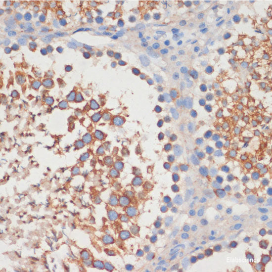 Immunohistochemistry of paraffin-embedded Human placenta using SARS2 Polyclonal Antibody at dilution of 1:100 (40x lens).