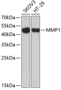 Western blot analysis of extracts of various cell lines using CD127 Polyclonal Antibody at dilution of 1:1000.