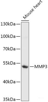 Immunohistochemistry of paraffin-embedded Rat spleen using CD3D Polyclonal Antibody at dilution of 1:200 (40x lens).