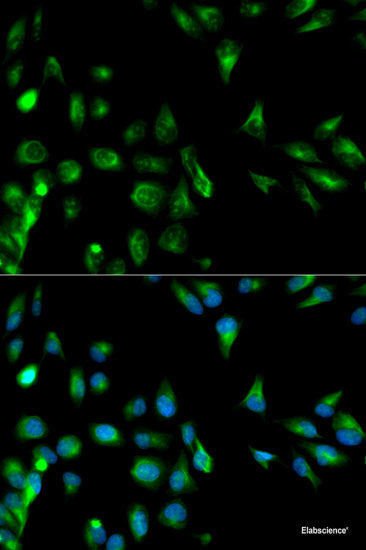 Western blot analysis of extracts of MCF-7 cells using CGA Polyclonal Antibody at dilution of 1:1000.