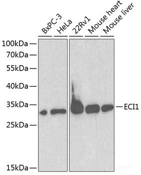 Western blot analysis of extracts of various cell lines using HSP90AA1 Polyclonal Antibody at dilution of 1:1000.