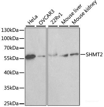 Western blot analysis of extracts of Mouse kidney using PIK3CA Polyclonal Antibody at dilution of 1:1000.
