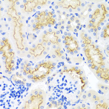 Immunohistochemistry of paraffin-embedded Human prostate using PTHLH Polyclonal Antibody at dilution of 1:100 (40x lens).