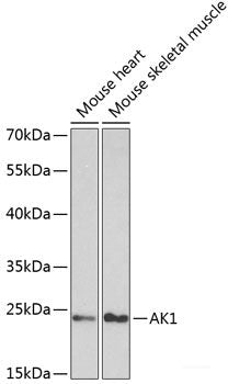 Western blot analysis of extracts of various cell lines using SELP Polyclonal Antibody at dilution of 1:1000.