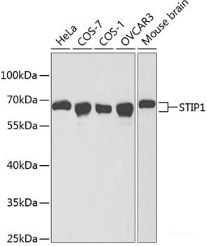 Immunohistochemistry of paraffin-embedded Rat kidney using SURF1 Polyclonal Antibody at dilution of 1:100 (40x lens).