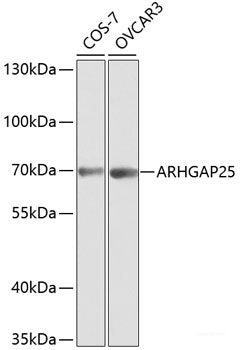 Immunohistochemistry of paraffin-embedded Human prostate using VEGFC Polyclonal Antibody at dilution of 1:100 (40x lens).