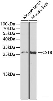 Immunohistochemistry of paraffin-embedded Human mammary cancer using SLC30A1 Polyclonal Antibody at dilution of 1:100 (40x lens).