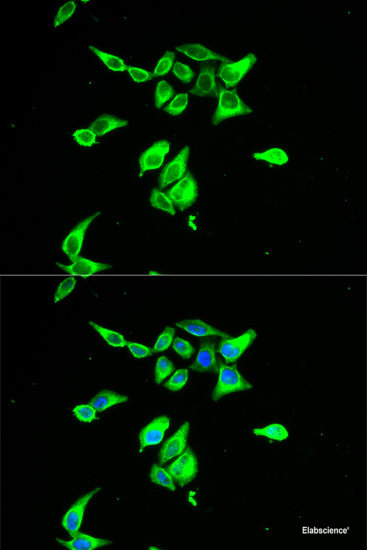 Immunofluorescence analysis of Mouse intestine using TRPA1 Polyclonal Antibody at dilution of 1:100. Blue: DAPI for nuclear staining.