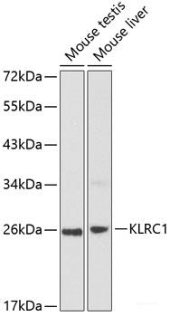Western blot analysis of extracts of various cell lines using ASAH2 Polyclonal Antibody at dilution of 1:1000.