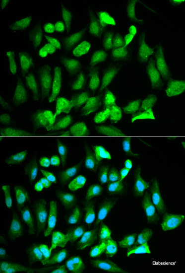 Western blot analysis of extracts of various cell lines using Aromatase Polyclonal Antibody at dilution of 1:3000.