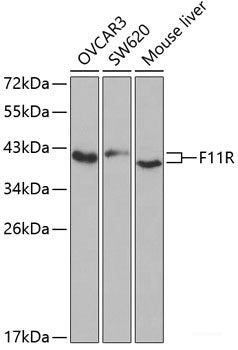 Immunohistochemistry of paraffin-embedded Rat lung using NLRP3 Polyclonal Antibody at dilution of 1:100 (40x lens).