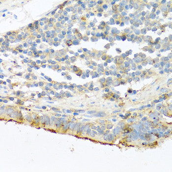 Immunohistochemistry of paraffin-embedded Rat kidney using ACSL5 Polyclonal Antibody at dilution of 1:100 (40x lens).