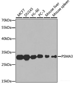 Western blot analysis of extracts of various cell lines using BTK Polyclonal Antibody at dilution of 1:1000.