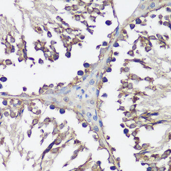 Immunofluorescence analysis of NIH/3T3 cells using PDIA2 Polyclonal Antibody at dilution of 1:100. Blue: DAPI for nuclear staining.