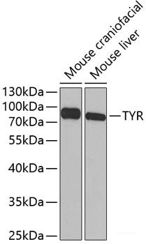 Western blot analysis of extracts of various cell lines using RCOR1 Polyclonal Antibody at dilution of 1:3000.