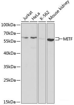 Western blot analysis of extracts of various cell lines using NDUFS2 Polyclonal Antibody at dilution of 1:3000.