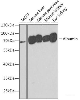 Western blot analysis of extracts of various cell lines using EIF4E3 Polyclonal Antibody at dilution of 1:3000.