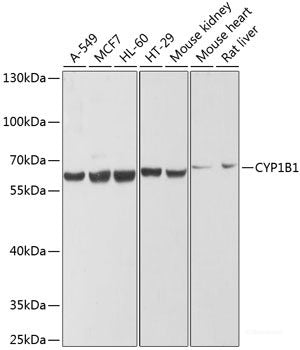 Immunohistochemistry of paraffin-embedded Human kidney cancer using STMN1 Polyclonal Antibody at dilution of 1:200 (40x lens).