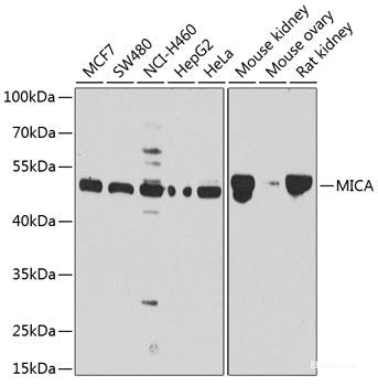 Western blot analysis of extracts of various cell lines using NOP16 Polyclonal Antibody at dilution of 1:3000.