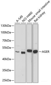 Immunohistochemistry of paraffin-embedded Rat kidney using EPHX2 Polyclonal Antibody at dilution of 1:200 (40x lens).