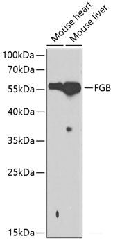Immunofluorescence analysis of C6 cells using CBS Polyclonal Antibody at dilution of 1:100. Blue: DAPI for nuclear staining.