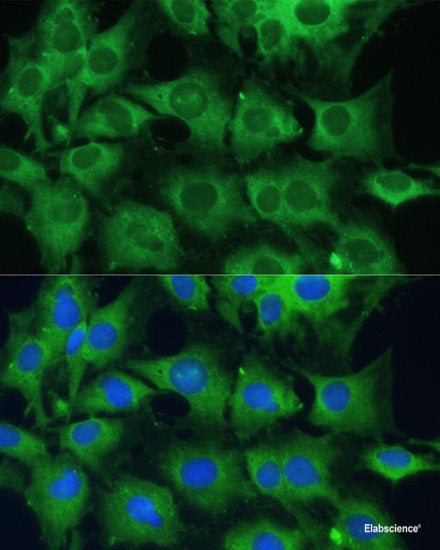 Immunofluorescence analysis of L929 cells using RHBDD1 Polyclonal Antibody at dilution of 1:100 (40x lens). Blue: DAPI for nuclear staining.