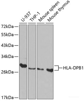 Western blot analysis of extracts of Rat liver using CCDC70 Polyclonal Antibody at dilution of 1:3000.