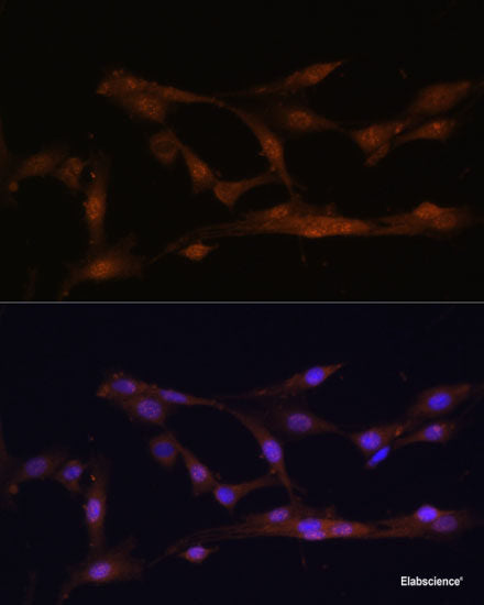 Immunohistochemistry of paraffin-embedded Human colon carcinoma using HIGD1A Polyclonal Antibody at dilution of 1:100 (40x lens).