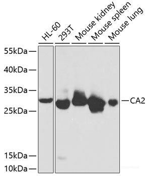 Immunofluorescence analysis of HCT116 cells using KDM7A Polyclonal Antibody at dilution of 1:150. Blue: DAPI for nuclear staining.