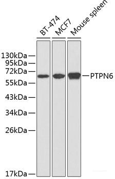 Immunofluorescence analysis of Rat brain using HCRTR1 Polyclonal Antibody at dilution of 1:100. Blue: DAPI for nuclear staining.