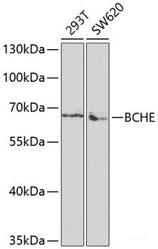 Immunohistochemistry of paraffin-embedded Rat testis using Polyclonal AntibodyPC1 Polyclonal Antibody at dilution of 1:100 (40x lens).