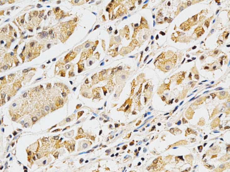 Immunohistochemistry of paraffin-embedded Rat brain using ZNF415 Polyclonal Antibody at dilution of 1:100 (40x lens).