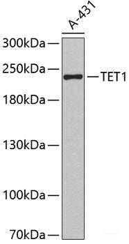 Western blot analysis of extracts of various cell lines using IVD Polyclonal Antibody at dilution of 1:1000.