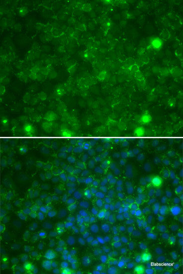 Immunofluorescence analysis of L929 cells using COL4A3BP Polyclonal Antibody at dilution of 1:100. Blue: DAPI for nuclear staining.
