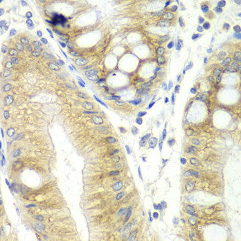 Immunofluorescence analysis of Mouse brain using RUSC1 Polyclonal Antibody at dilution of 1:100. Blue: DAPI for nuclear staining.