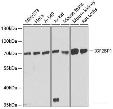 Immunofluorescence analysis of C6 cells using ARID1B Polyclonal Antibody at dilution of 1:100. Blue: DAPI for nuclear staining.