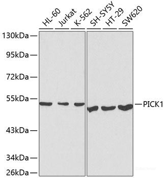 Immunofluorescence analysis of U-2 OS cells using LLPH Polyclonal Antibody at dilution of 1:100. Blue: DAPI for nuclear staining.