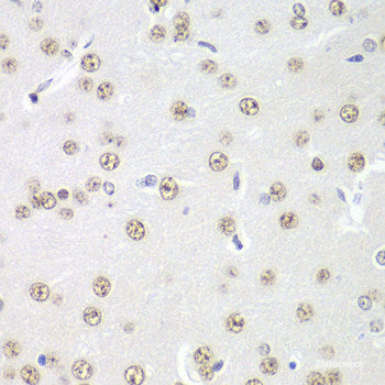 Western blot analysis of extracts of A-549 cells using TOP1MT Polyclonal Antibody at dilution of 1:1000.
