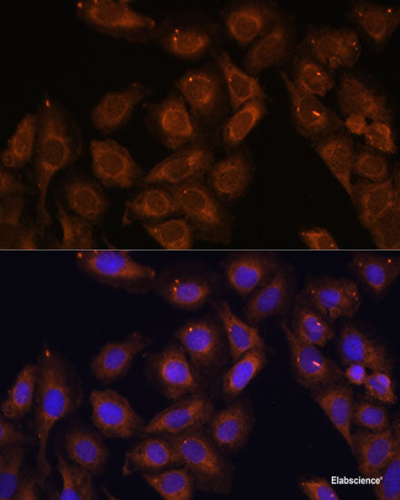 Western blot analysis of extracts of various cell lines using CDY1B Polyclonal Antibody at dilution of 1:1000.