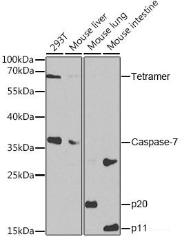 Immunohistochemistry of paraffin-embedded Rat lung using YTHDF2 Polyclonal Antibody at dilution of 1:100 (40x lens).