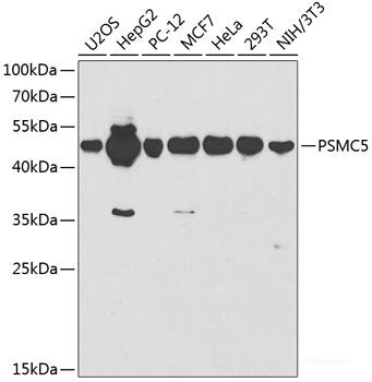 Immunofluorescence analysis of L929 cells using IL10RB Polyclonal Antibody at dilution of 1:100. Blue: DAPI for nuclear staining.