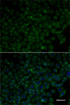 Immunofluorescence analysis of L929 cells using TBRG4 Polyclonal Antibody at dilution of 1:100. Blue: DAPI for nuclear staining.