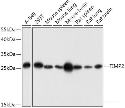 Immunofluorescence analysis of U-2 OS cells using SF3B1 Polyclonal Antibody at dilution of 1:100. Blue: DAPI for nuclear staining.